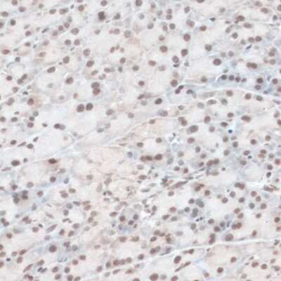 Immunohistochemistry-Paraffin: ZNF574 Antibody - Azide and BSA Free [NBP3-04776]